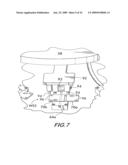 PROCESS AND MACHINE FOR AUTOMATED MANUFACTURE OF GASTRO-RETENTIVE CAPSULES diagram and image