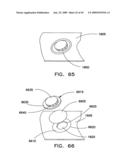 BATTERY SYSTEM HAVING INTERCONNECTED BATTERY PACKS EACH HAVING MULTIPLE ELECTROCHEMICAL STORAGE CELLS diagram and image