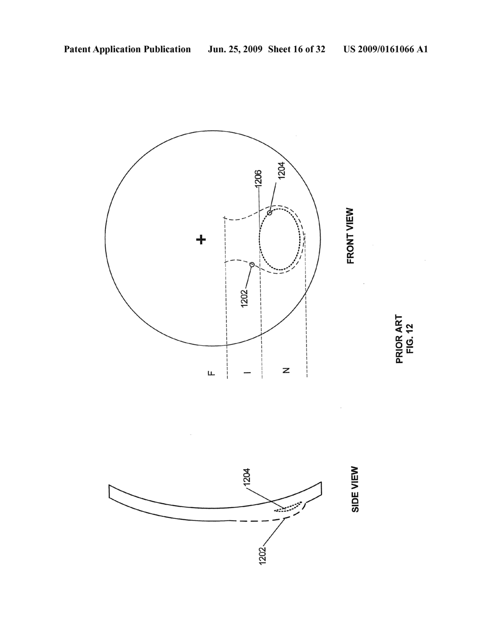 MULTIPLE LAYER MULTIFOCAL COMPOSITE LENS - diagram, schematic, and image 17