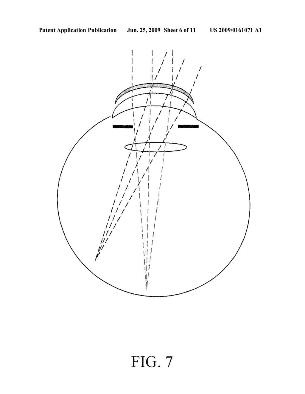 Customized Z-Lens Design Program - diagram, schematic, and image 07