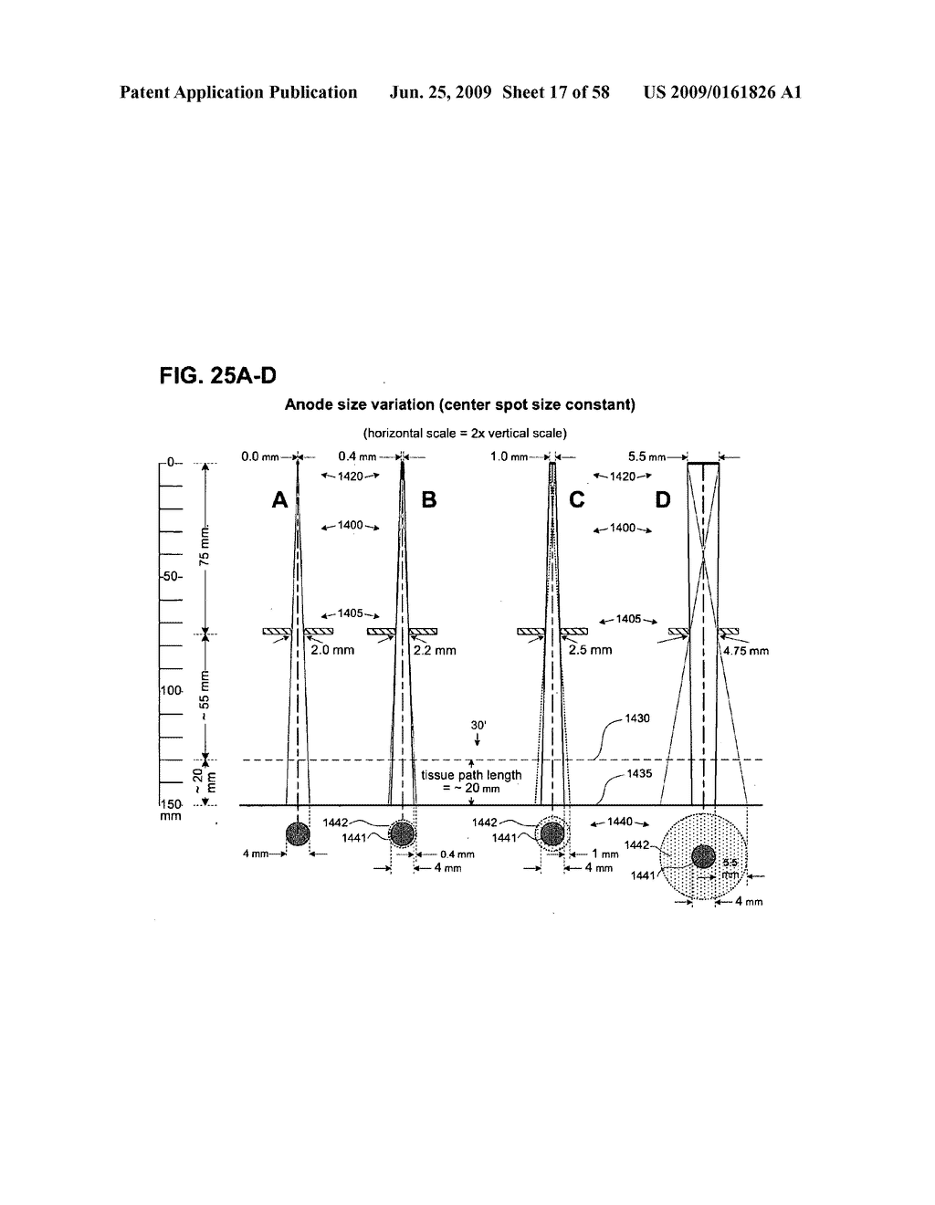 METHODS AND DEVICES FOR ORTHOVOLTAGE OCULAR RADIOTHERAPY AND TREATMENT PLANNING - diagram, schematic, and image 18