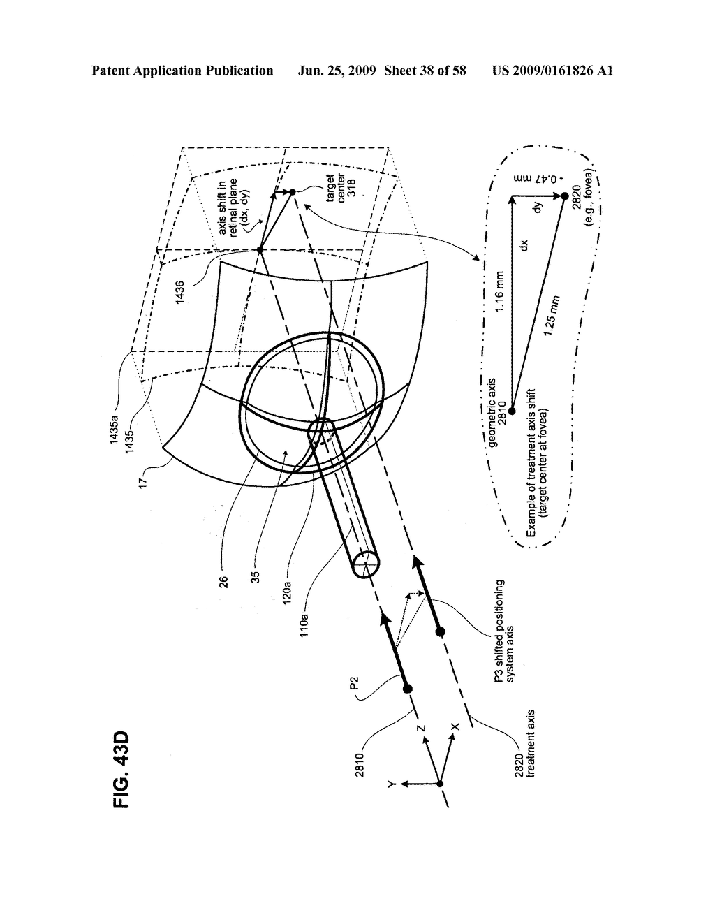 METHODS AND DEVICES FOR ORTHOVOLTAGE OCULAR RADIOTHERAPY AND TREATMENT PLANNING - diagram, schematic, and image 39