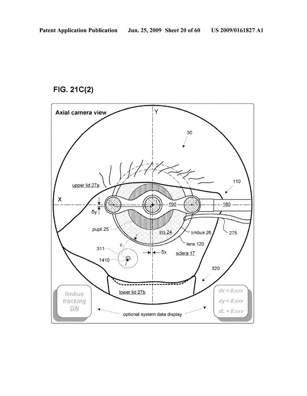 METHODS AND DEVICES FOR DETECTING, CONTROLLING, AND PREDICTING RADIATION DELIVERY - diagram, schematic, and image 21