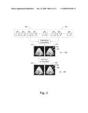 QUANTITATIVE REAL-TIME 4D STRESS TEST ANALYSIS diagram and image