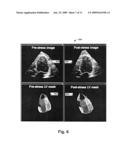 QUANTITATIVE REAL-TIME 4D STRESS TEST ANALYSIS diagram and image