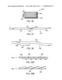 STITCHES ELIMINATION STRUCTURE AND METHOD TO PROVIDE THE SAME diagram and image