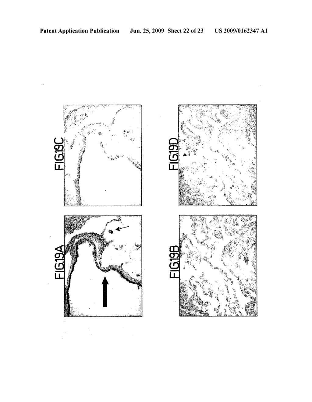 METHODS, COMPOSITIONS, AND KITS RELATING TO CHITINASES AND CHITINASE-LIKE MOLECULES AND INFLAMMATORY DISEASE - diagram, schematic, and image 23