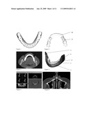 Method for (semi-) automatic dental implant planning diagram and image