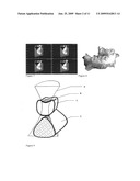 Method for (semi-) automatic dental implant planning diagram and image