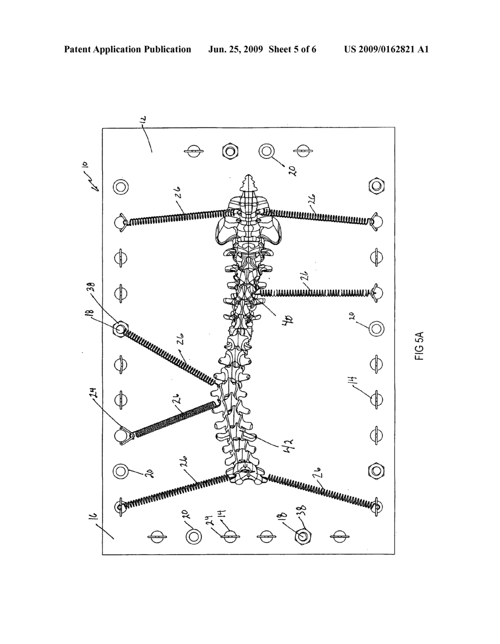 SPINAL SURGERY MODELING SYSTEM - diagram, schematic, and image 06