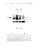 BREAST CANCER RELATED PROTEIN, GENE ENCODING THE SAME, AND METHOD OF DIAGNOSING BREAST CANCER USING THE PROTEIN AND GENE diagram and image