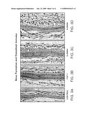 DENTAL PRODUCTS COMPRISING BONE GROWTH ENHANCING PEPTIDE diagram and image