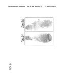 FXR Agonists for the Treatment of Nonalcoholic Fatty Liver and Cholesterol Gallstone Diseases diagram and image