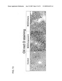 FXR Agonists for the Treatment of Nonalcoholic Fatty Liver and Cholesterol Gallstone Diseases diagram and image