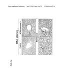 FXR Agonists for the Treatment of Nonalcoholic Fatty Liver and Cholesterol Gallstone Diseases diagram and image