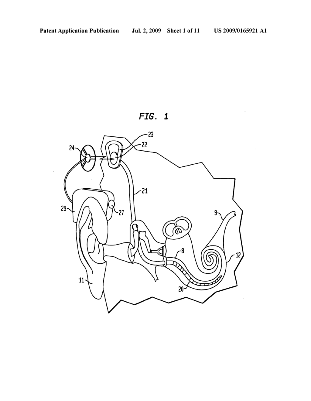 COCHLEAR IMPLANT ASSEMBLY - diagram, schematic, and image 02