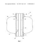 CASING DEFORMATION AND CONTROL FOR INCLUSION PROPAGATION diagram and image