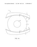 Non-Invasive Measurement of Tear Volume Systems and Methods diagram and image