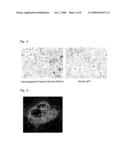 DIAGNOSTIC AGENT AND THERAPEUTIC AGENT FOR DISEASE ASSOCIATED WITH HEPATOCYTE GROWTH FACTOR RECEPTOR diagram and image