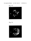 DIAGNOSTIC AGENT AND THERAPEUTIC AGENT FOR DISEASE ASSOCIATED WITH HEPATOCYTE GROWTH FACTOR RECEPTOR diagram and image