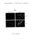 Stimulus Inducible Protein Kinase Complex and Methods of Use Therefor diagram and image