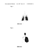 Pharmaceutical Compositions Comprising Cyclosporin diagram and image