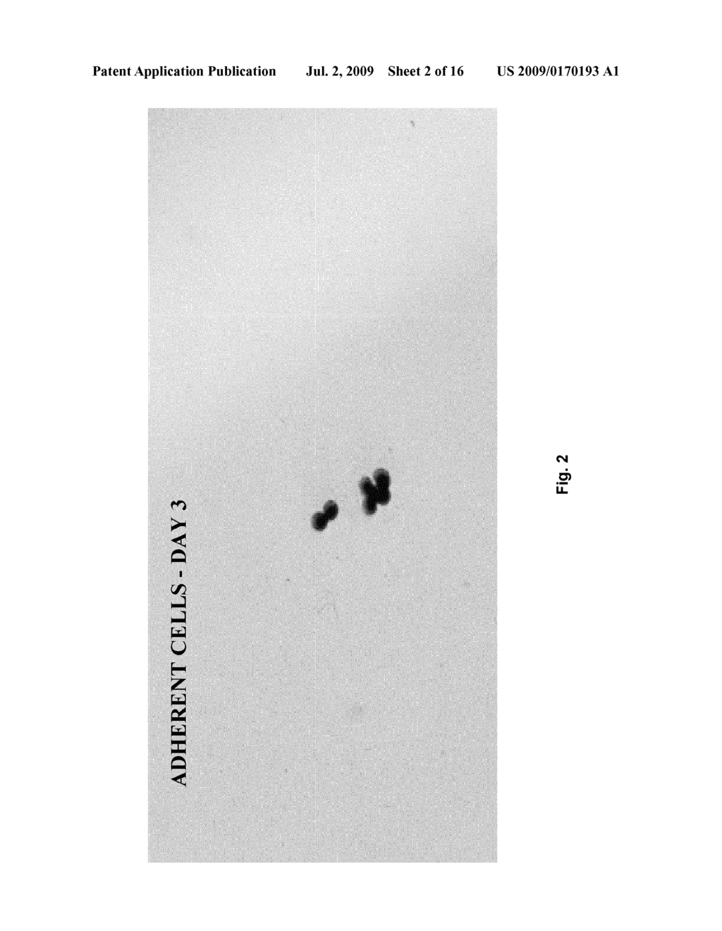 STEM CELLS - diagram, schematic, and image 03