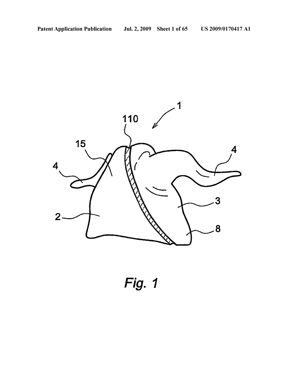 Method and Device for Processing a Carcass Part of Slaughtered Poultry - diagram, schematic, and image 02