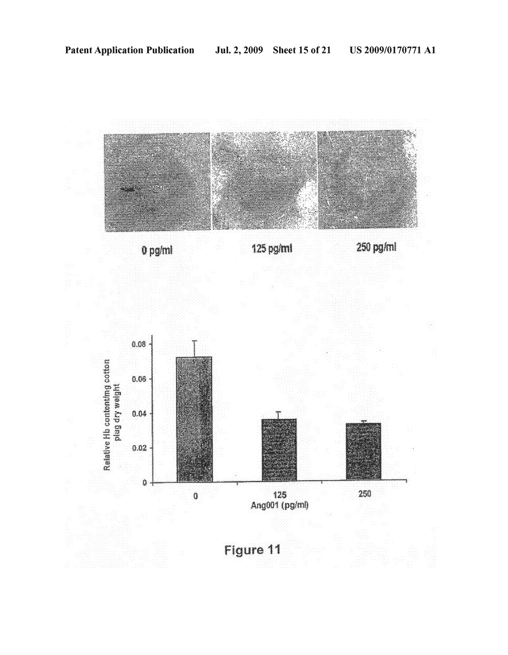 Anti-angiogenic agents and methods of their use - diagram, schematic, and image 16