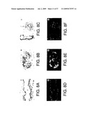 Hunk, a snfi-related kinase essential for mammary tumor metastasis diagram and image