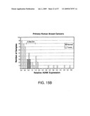 Hunk, a snfi-related kinase essential for mammary tumor metastasis diagram and image