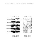 Hunk, a snfi-related kinase essential for mammary tumor metastasis diagram and image