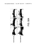 Hunk, a snfi-related kinase essential for mammary tumor metastasis diagram and image