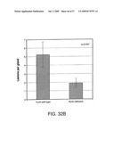 Hunk, a snfi-related kinase essential for mammary tumor metastasis diagram and image