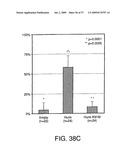 Hunk, a snfi-related kinase essential for mammary tumor metastasis diagram and image