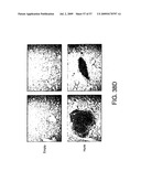 Hunk, a snfi-related kinase essential for mammary tumor metastasis diagram and image