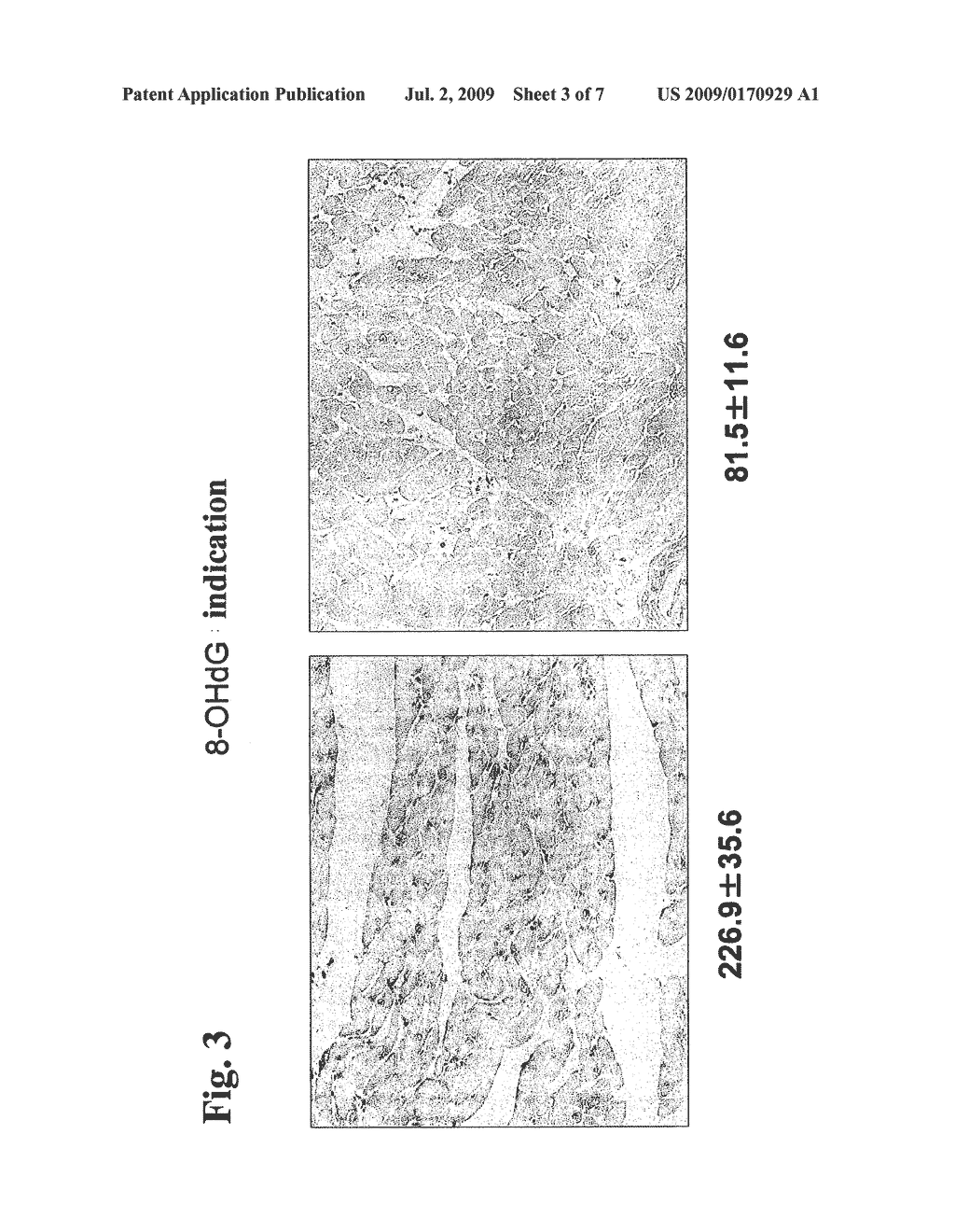 Composition for the Protection and Preservation of Organs, Tissues or Cells and the Use Thereof - diagram, schematic, and image 04