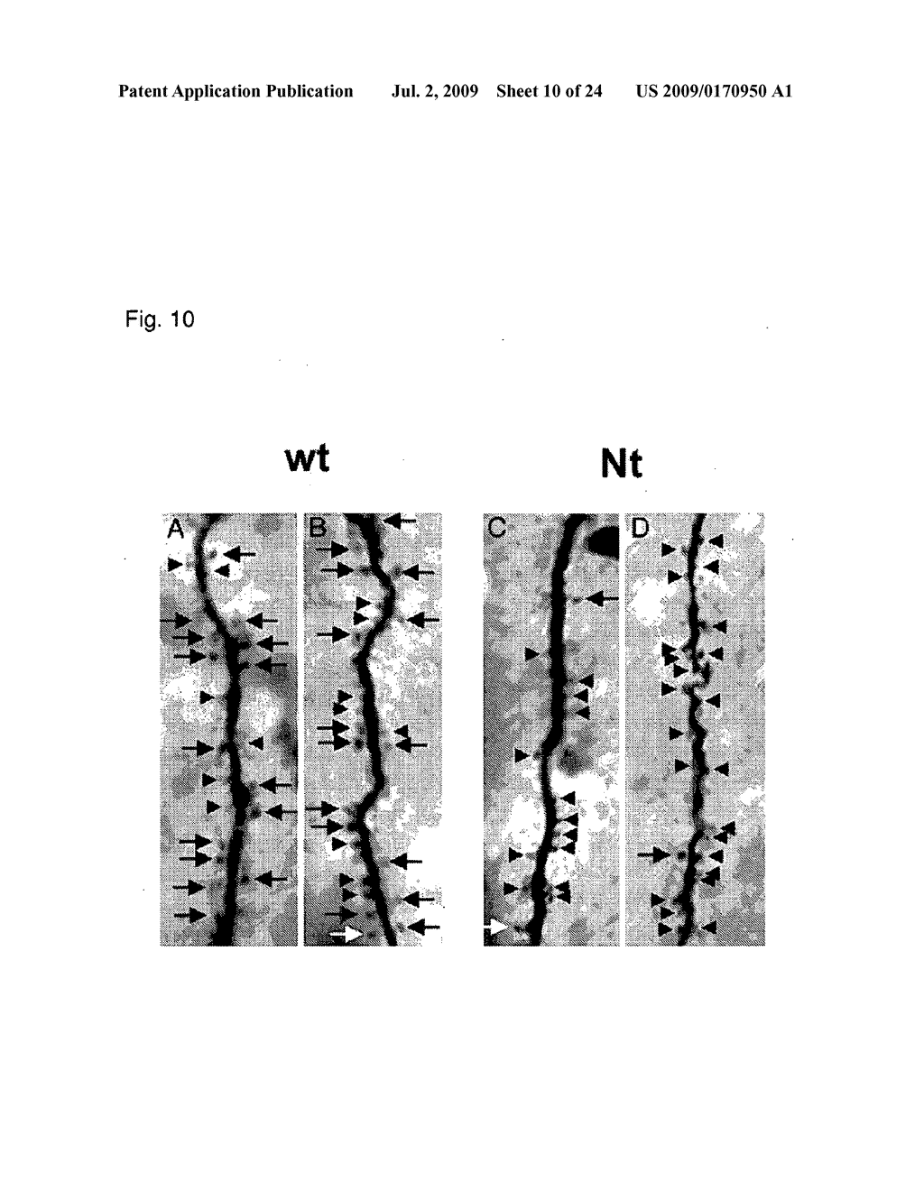 Inhibitors Of Neurotrypsin - diagram, schematic, and image 11