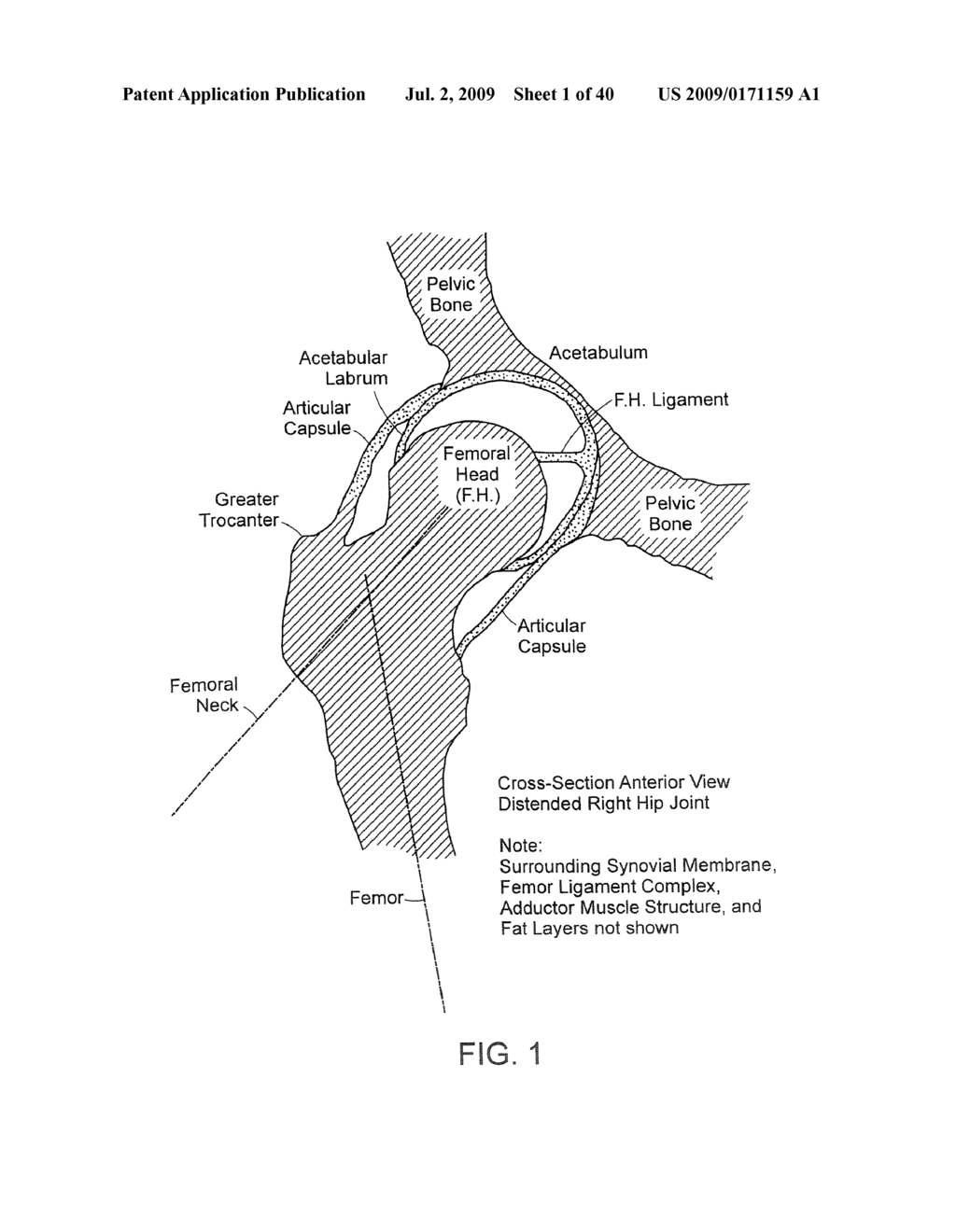 Method and Devices for Minimally Invasive Arthroscopic Procedures - diagram, schematic, and image 02