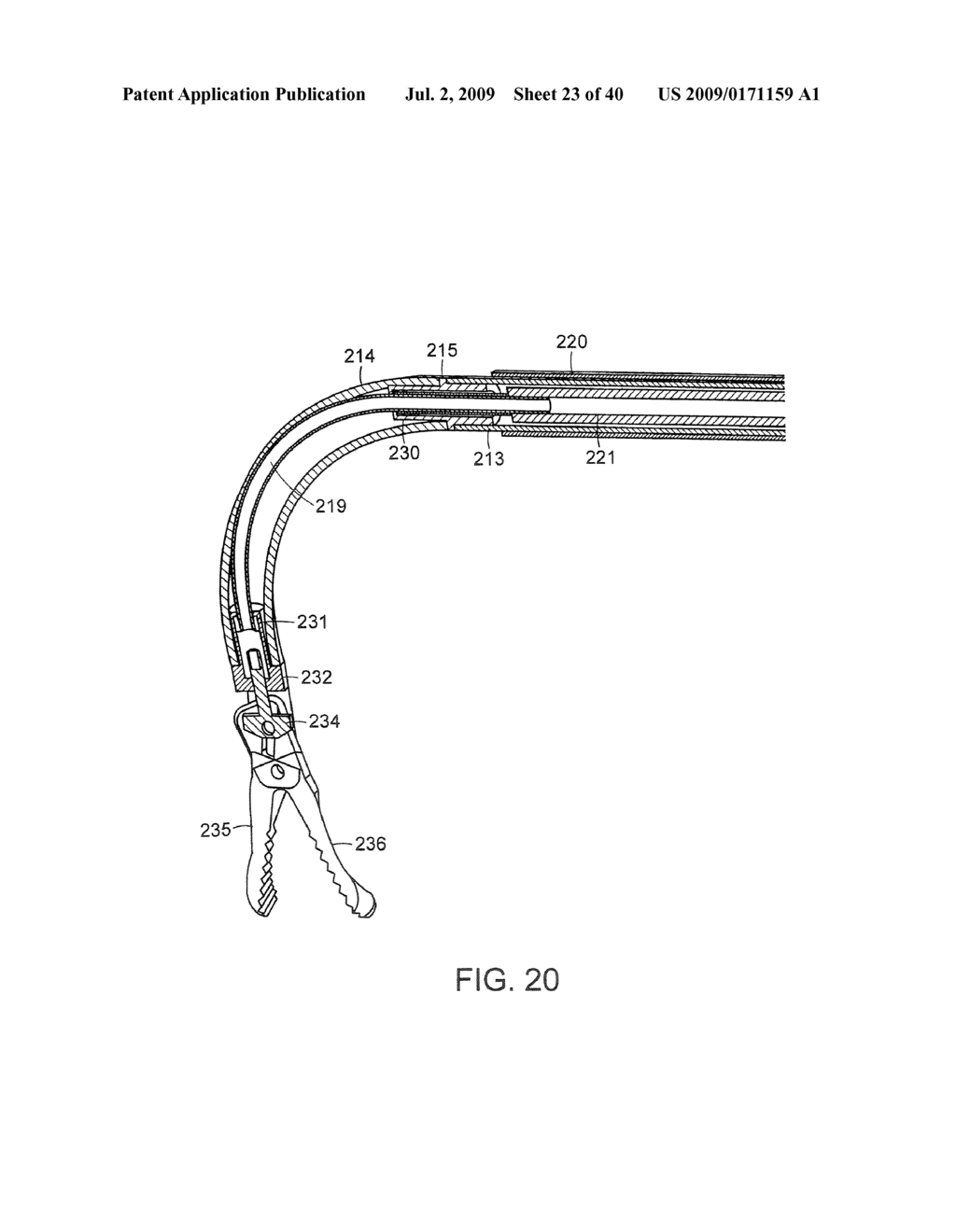 Method and Devices for Minimally Invasive Arthroscopic Procedures - diagram, schematic, and image 24