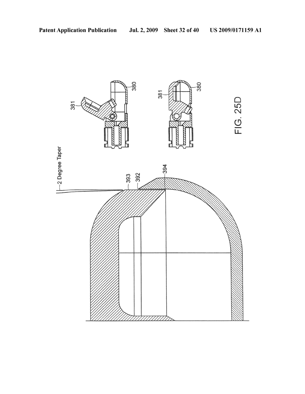 Method and Devices for Minimally Invasive Arthroscopic Procedures - diagram, schematic, and image 33