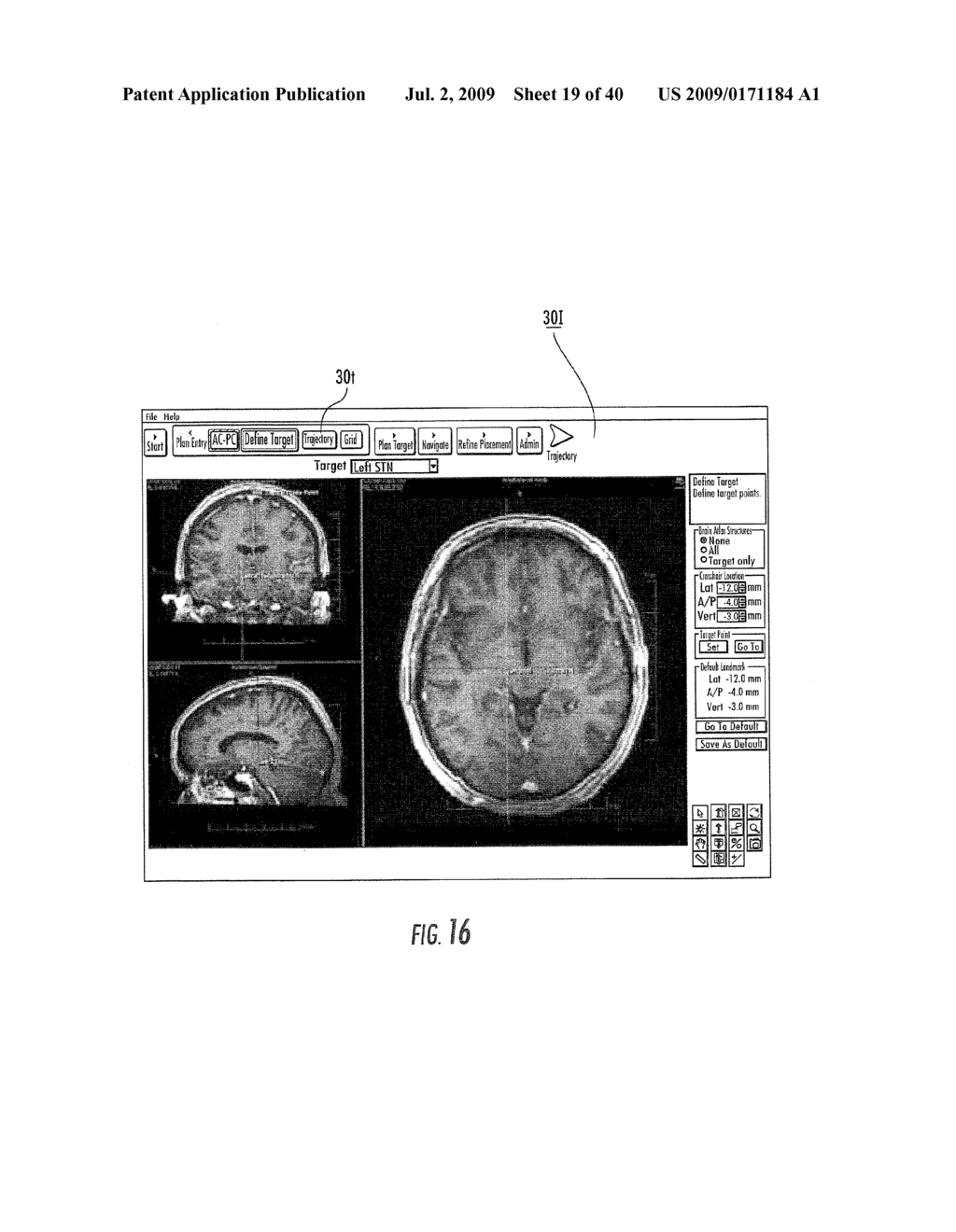 MRI SURGICAL SYSTEMS FOR REAL-TIME VISUALIZATIONS USING MRI IMAGE DATA AND PREDEFINED DATA OF SURGICAL TOOLS - diagram, schematic, and image 20