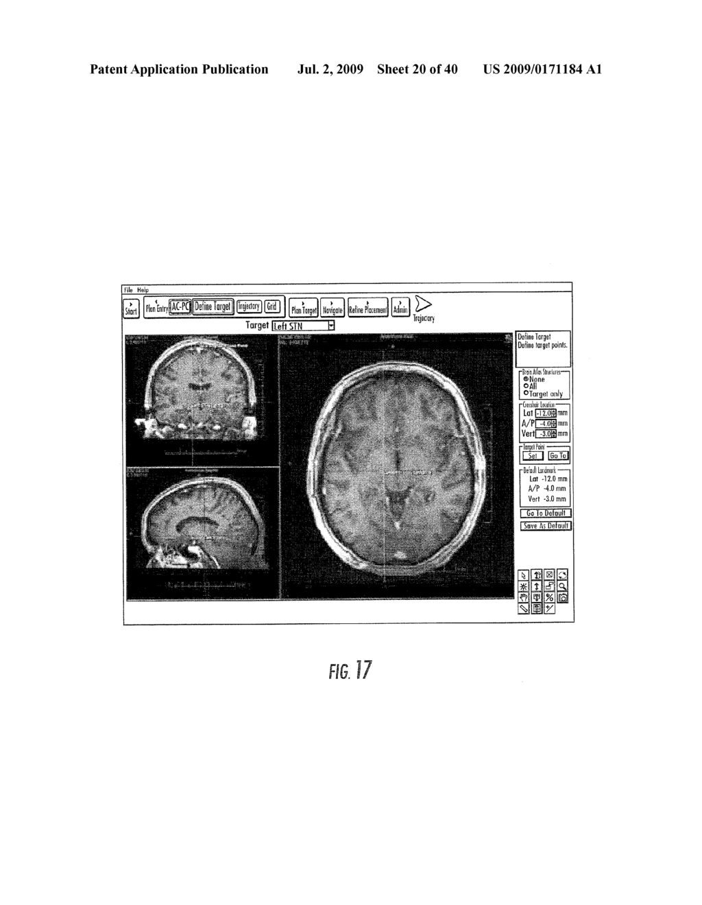 MRI SURGICAL SYSTEMS FOR REAL-TIME VISUALIZATIONS USING MRI IMAGE DATA AND PREDEFINED DATA OF SURGICAL TOOLS - diagram, schematic, and image 21