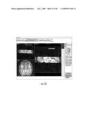 MRI SURGICAL SYSTEMS FOR REAL-TIME VISUALIZATIONS USING MRI IMAGE DATA AND PREDEFINED DATA OF SURGICAL TOOLS diagram and image