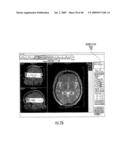 MRI SURGICAL SYSTEMS FOR REAL-TIME VISUALIZATIONS USING MRI IMAGE DATA AND PREDEFINED DATA OF SURGICAL TOOLS diagram and image