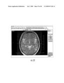 MRI SURGICAL SYSTEMS FOR REAL-TIME VISUALIZATIONS USING MRI IMAGE DATA AND PREDEFINED DATA OF SURGICAL TOOLS diagram and image