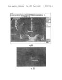 MRI SURGICAL SYSTEMS FOR REAL-TIME VISUALIZATIONS USING MRI IMAGE DATA AND PREDEFINED DATA OF SURGICAL TOOLS diagram and image