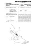 METHODS OF INJECTING FLUIDS INTO JOINTS USING A HANDPIECE ASSEMBLY diagram and image