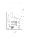 METHODS OF INJECTING FLUIDS INTO JOINTS USING A HANDPIECE ASSEMBLY diagram and image