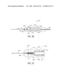 METHODS OF INJECTING FLUIDS INTO JOINTS USING A HANDPIECE ASSEMBLY diagram and image